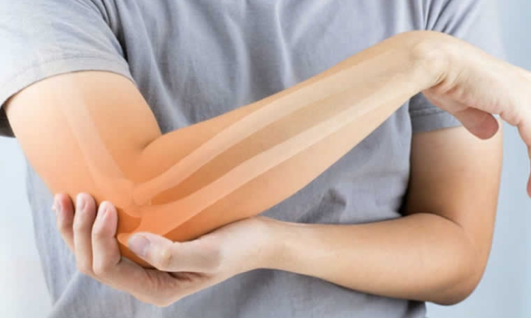 Μια ένεση αναζωογονεί τους ιστούς στις αρθρώσεις αποτρέποντας την αρθρίτιδα